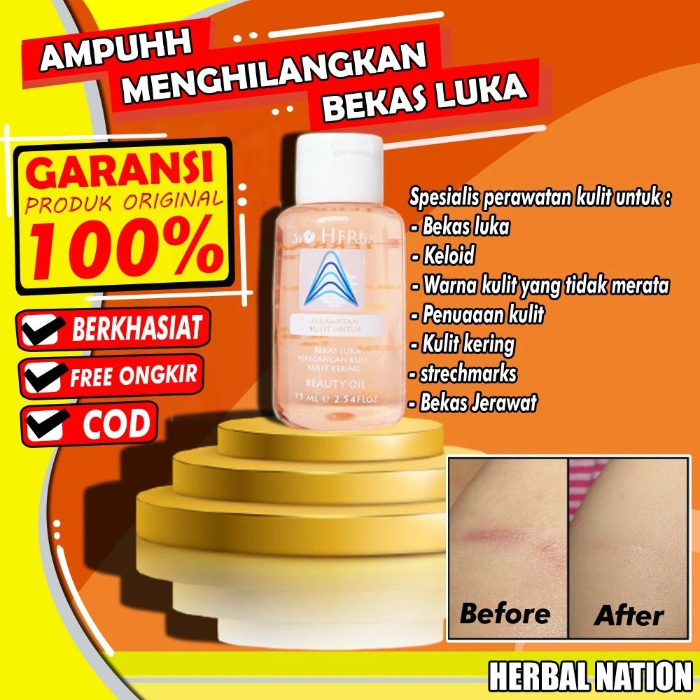 TERAMPUH!! Penghilang Bekas Luka Hitam Koreng Jerawat Bopeng strechmark keloid Ampuh I Bio Oil I