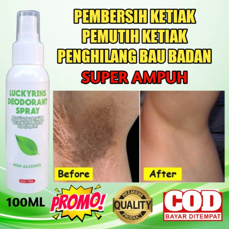 PEMBERSIH KETIAK PEMUTIH KETIAK PERAWAT KETIAK PENGHILANG BAU BADAN LUCKYRINS DEODORANT SPRAY