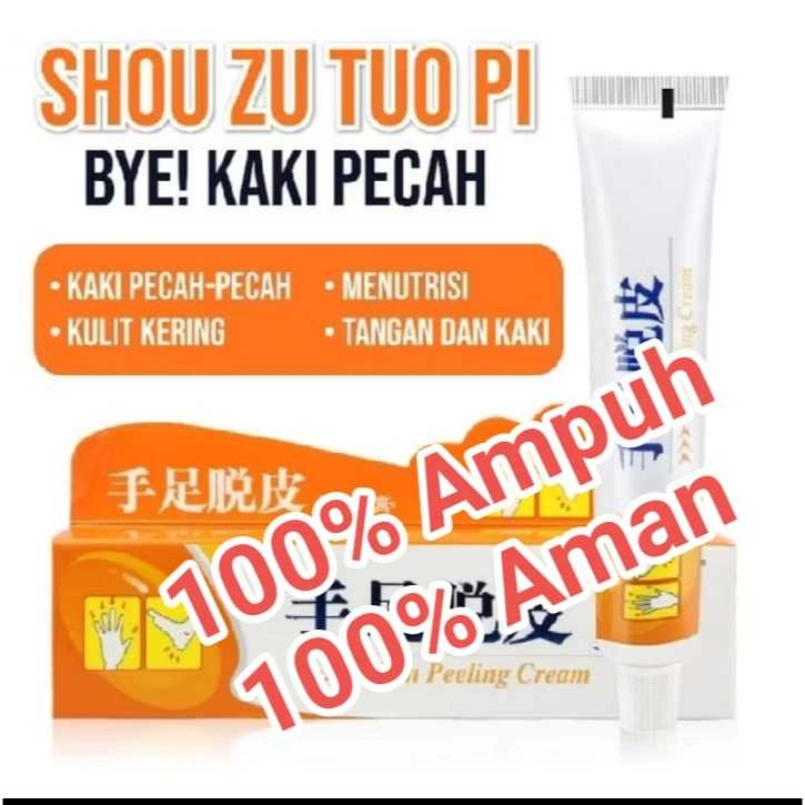 OBAT SALEP CREAM ORIGINAL TUMIT VERSI ORANGE UNTUK KAKI TANGAN KAPALAN KERING TEBAL RAYAPAN DAN PECAH AMPUH – SALEP KAKI PECAH KAPALAN KERING – OBAT TUMIT KASAR PECAH PECAH – CREAM KRIM TUMIT HALUS ORIGINAL AMPUH - SHOU ZU TOU