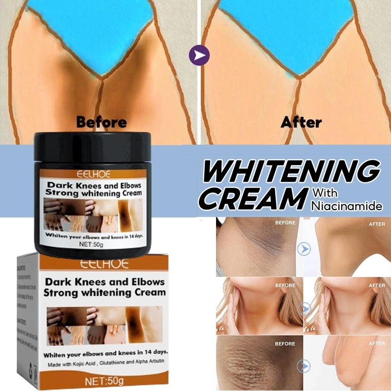 EELHOE Whitening Cream Pemutih Selangkangan Dan Miss V Pemutih Lutut Dan Siku Pemutih Dengkul Dan Siku Pemutih Ketiak Pencerah Selangkangan Lutut Hitam Memutihkan Badan