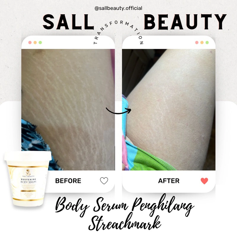 BPOM Body Whitening Serum (Penghilang Strechmark)