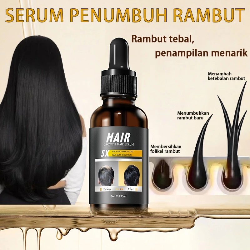Serum Pertumbuhan Rambut Anti Rontok Minyak Perawatan Rambut Penumbuh Rambut Perawatan Kulit Kepala