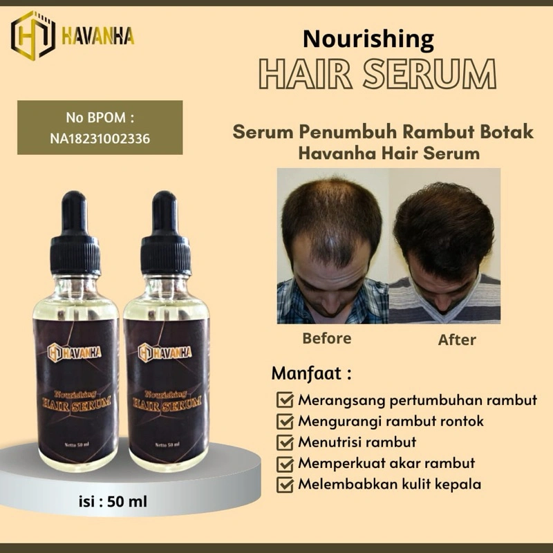 HAVANHA PENUMBUH RAMBUT BOTAK Cepat dan Tebal Wanita Pria Hair Serum Penumbuh Rambut Minyak Penyubur