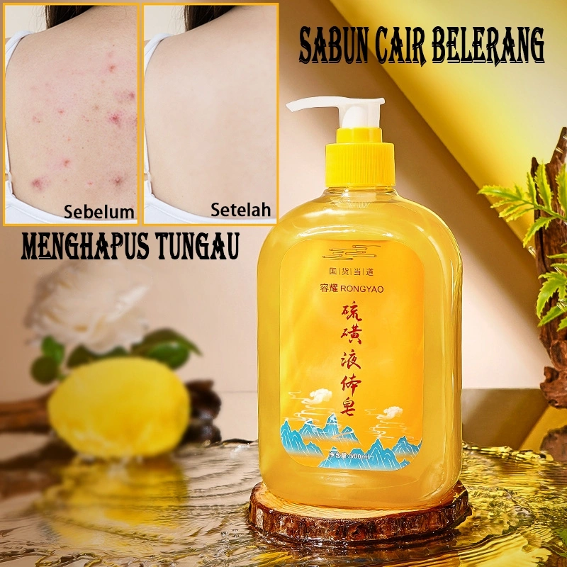 Penghilang tungau Sabun Cair Belerang 500ML Menghilangkan jerawat Menghentikan gatal Sabun Mandi
