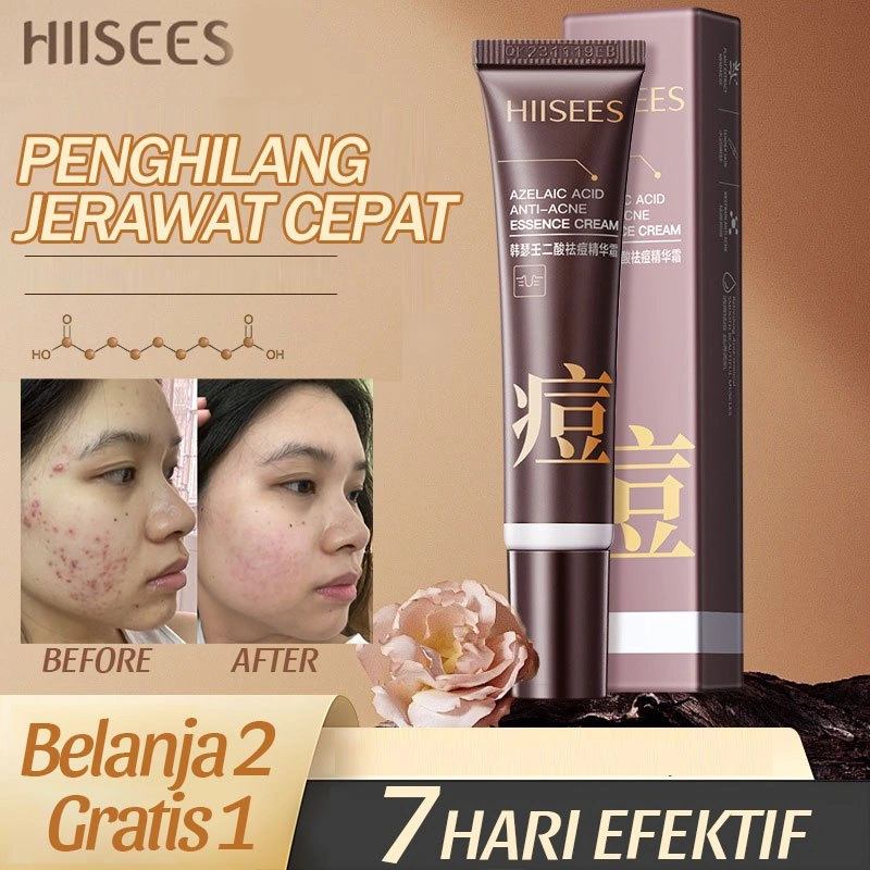 Cream Penghilang Jerawat 20g Penghilang Bekas Jerawat Ampuh/Crim Penghilang Bekas Jerawat