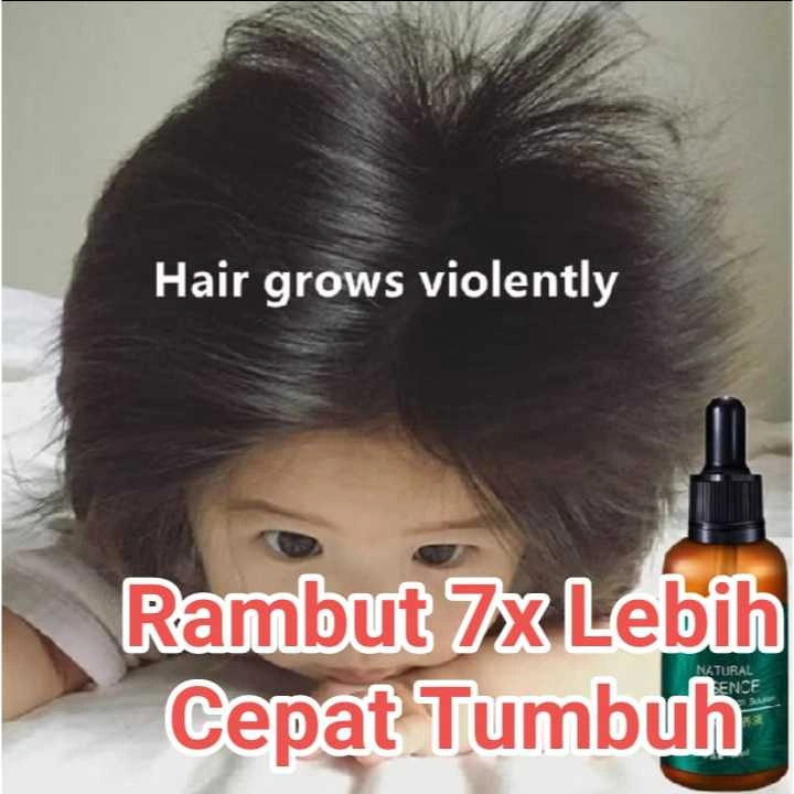 ZENSHOW Hair Care Hair Growth Essential Oils Essence Hair Loss Liquid Health Care Beauty Dense Hair Growth Serum -Serum Rambut Rontok-Penumbuh Rambut-Obat rambut botak-serum penumbuh rambut botak-Penumbuh rambut botak pria-mengurangi rambut rontok-COD amp