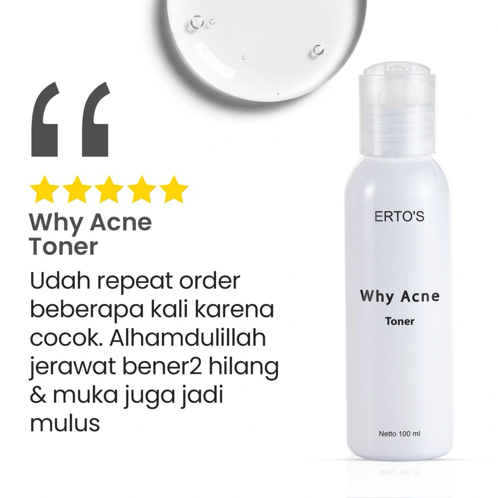 Why Acne Toner Ertos / Untuk Kulit Berminyak / Untuk Kulit Berjerawat / Acne Prone Skin / Oil Control / Anti Inflamasi / Acne Expert Toner