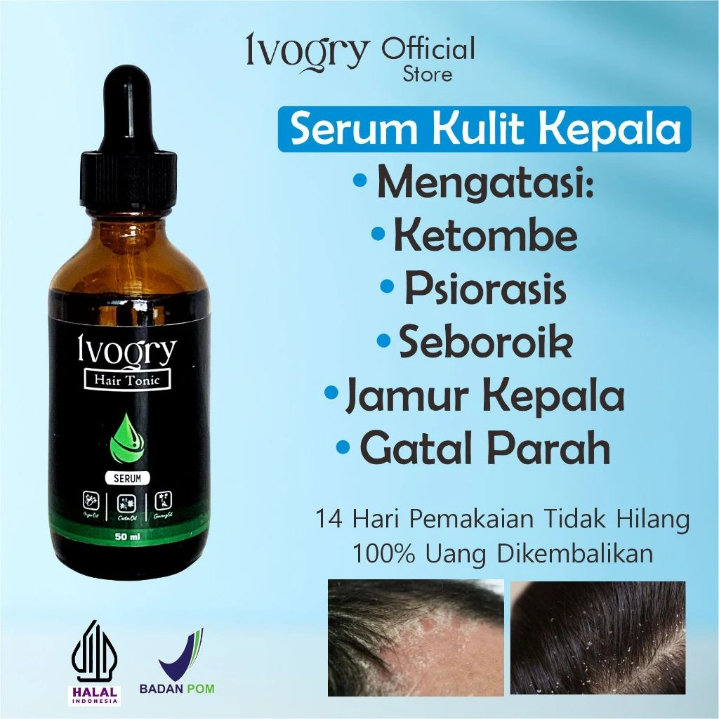 Ivogry Serum Ketombe & Kulit Kepala Gatal | BPOM | Halal | 55ml