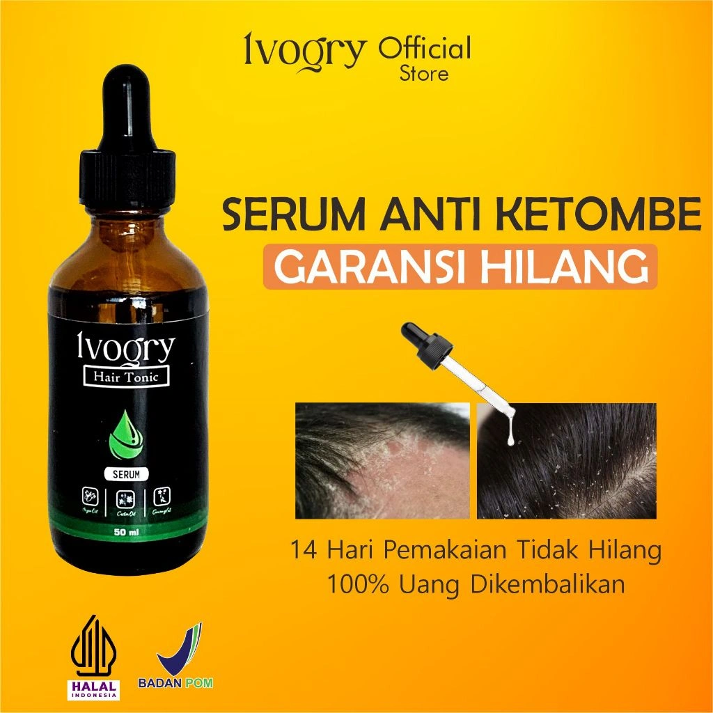 Serum Ivogry untuk Kulit Kepala Berketombe | Bantu Redakan Gatal & Minyak