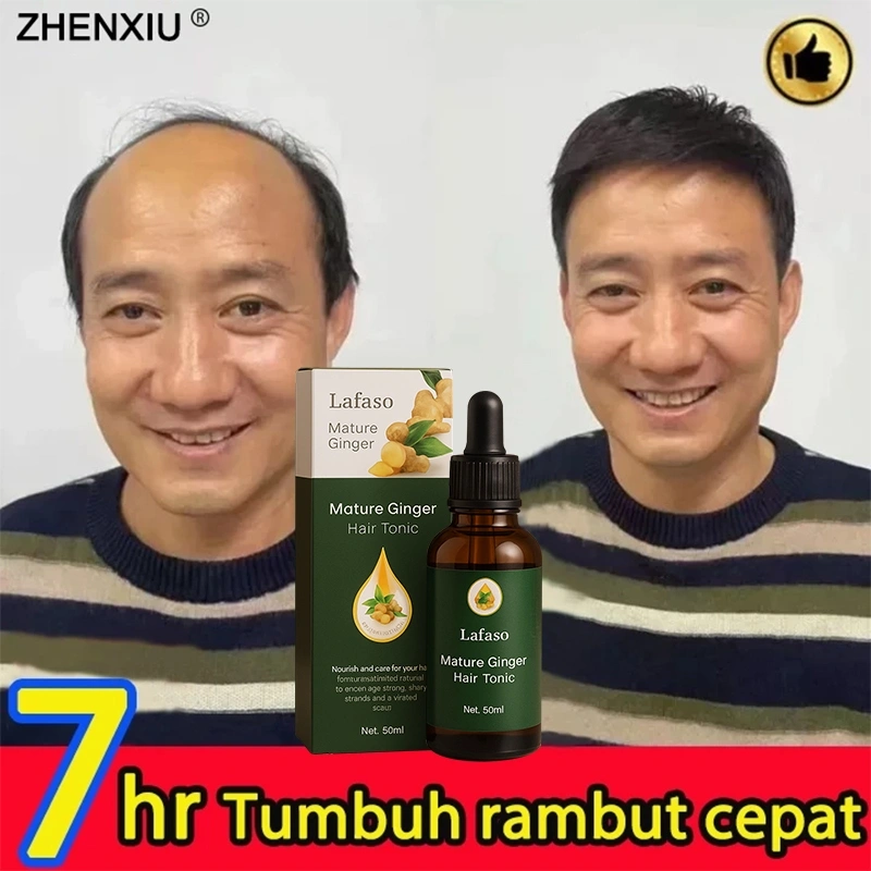 hair tonic-penumbuh rambut botak Menyehatkan Kulit Kepala&Meningkatkan Regenerasi Rambut/serum penumbuh rambut/penumbuh rambut cepat/serum rambut rontok/penebal rambut/minyak penumbuh rambut/natural essence penumbuh rambut/Obat penumbuh rambut super cepat