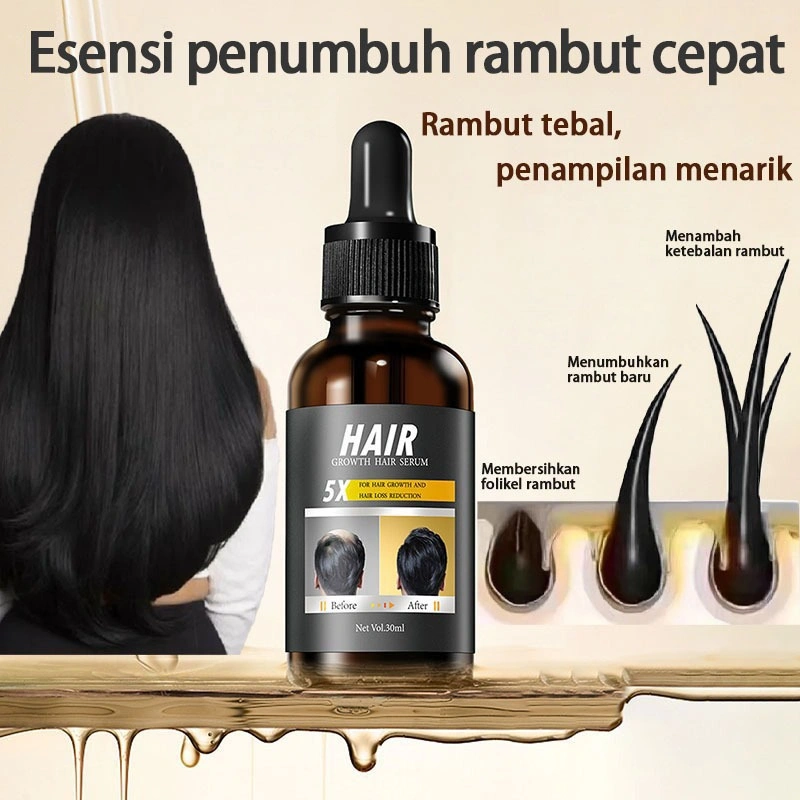 Serum Pertumbuhan Rambut Anti Rontok Minyak Perawatan Rambut Penumbuh Rambut Perawatan Kulit Kepala