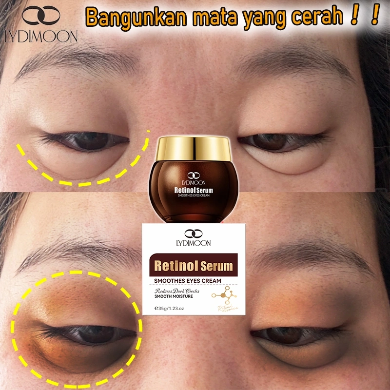Retinol Eye Cream Menghilangkan Kantung Mata dan mata panda Kerutan Krim Penghilang Milia eye cream anti aging 35G