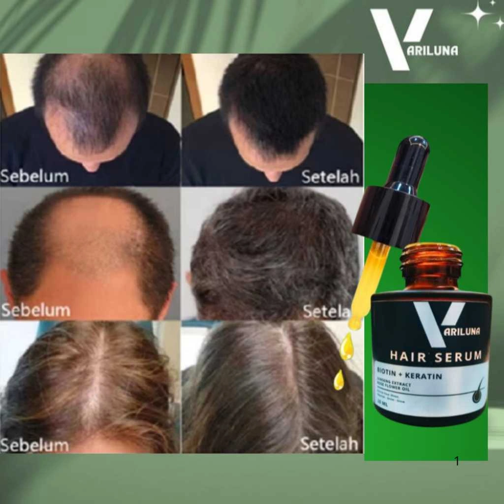 TSSJ Serum Penumbuh Rambut Vitamin Kebotakan Mencegah Mengatasi Kerontokan Pada Rambut Variluna