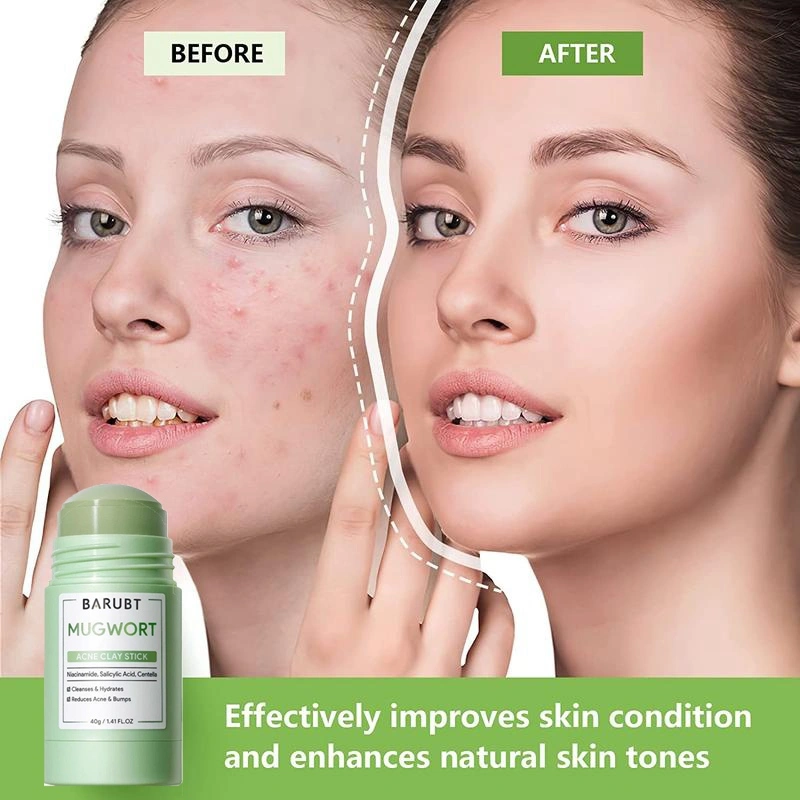 Tongkat Lumpur Pembersih Asam Salisilat Artemisia - Pereda Jerawat yang Kuat - Pembersihan Mendalam - Mengecilkan Pori - Menghilangkan Komedo - Masker Jerawat Pengelupasan - Masker Perawatan Kulit Tidur