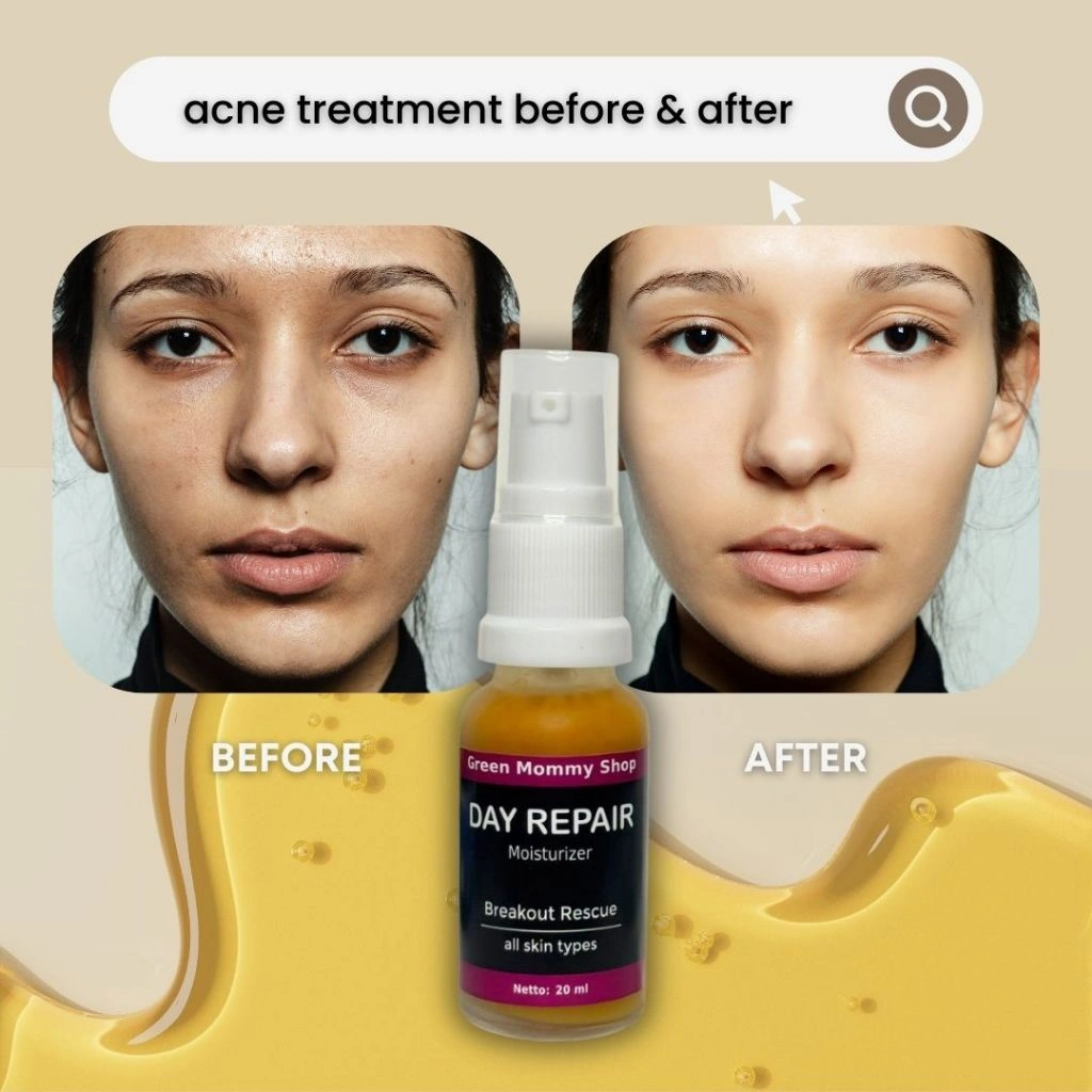 Green Mommy Shop | Day Repair Moisturizer | Organik untuk Kulit Berjerawat & Sensitif | 20ml