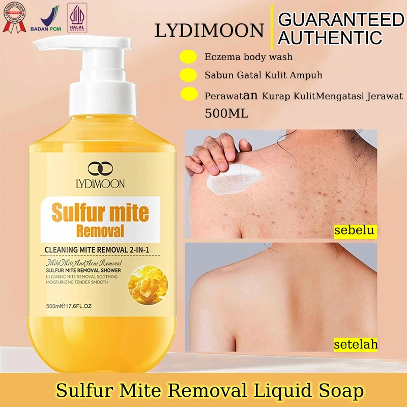 LYDIMOON-Penghilang tungau Sabun Cair Belerang 500ML Menghilangkan jerawat Menghentikan gatal