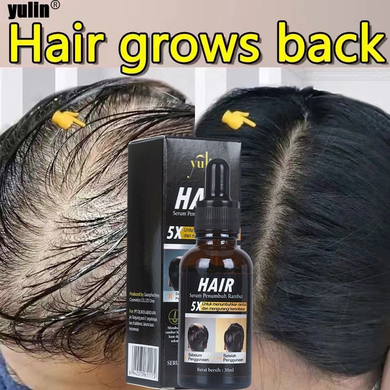 yulin Serum penumbuh rambut Obat untuk rambut penumbuh rambut serum penumbuh rambut hair serum rambut rontok Hair Growth vitamin penumbuh rambut hair tonic-serum buat rambut rontok-penumbuh rambut rontok-penebal rambut wanita-penumbuh rambut botak