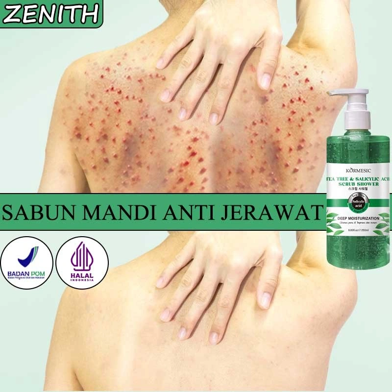 Acne body wash sabun jerawat punggung sabun mandi cair 250ML Acne Shower Gel Aroma Alami Mengatasi Kulit Jerawat Kering Gatal Anti Jamur bekas jerawat sabun badan body wash