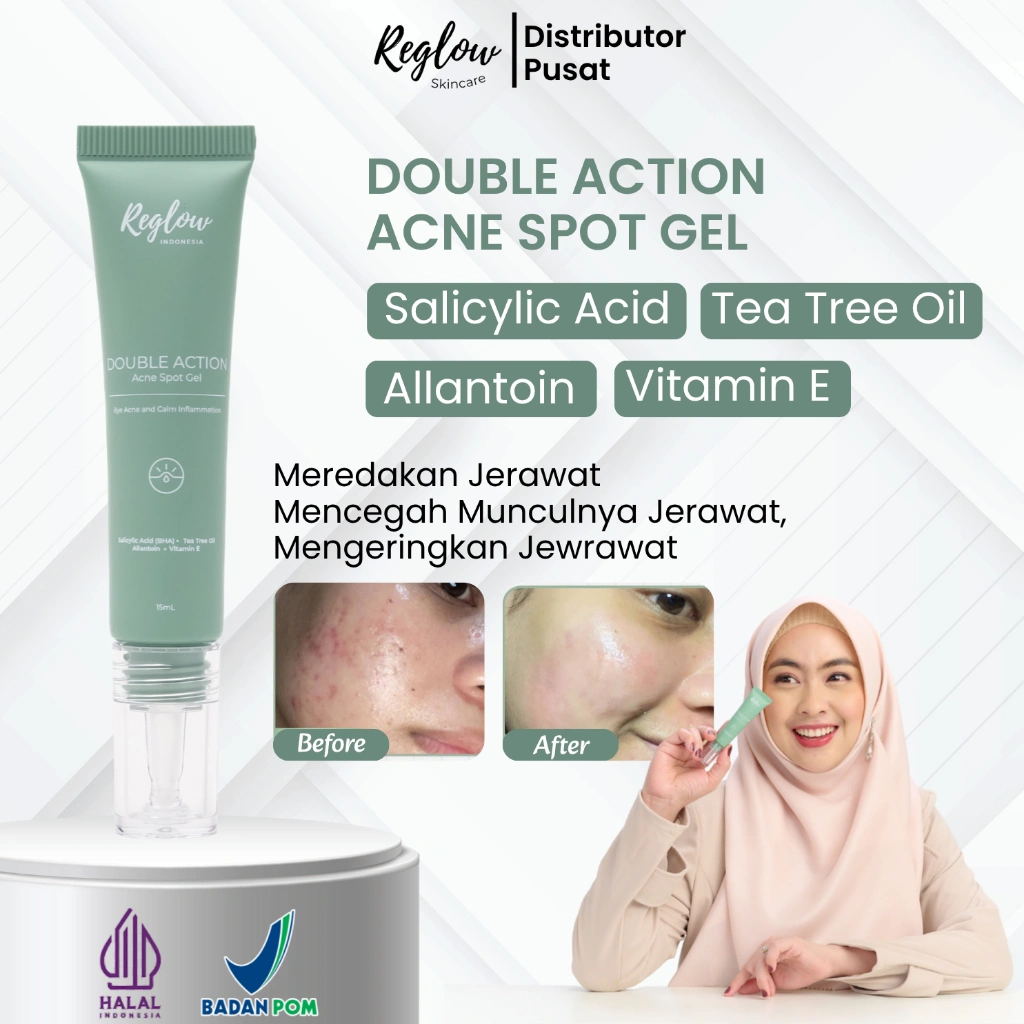 Acne | Acne Spot | Totol Jerawat | Skincare Acne | Penghilang Jerawat | Reglow | Acne Gel 15ml Bpom