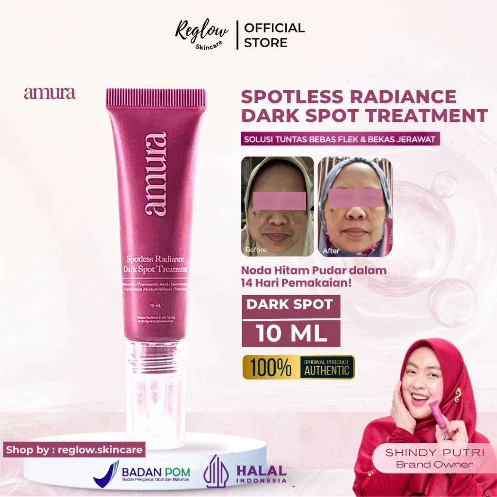 [COD] AMURA DARK SPOT Spotless Radiance Dark Spot Treatment-10ml | Perawatan Flek Hitam Mencerahkan Maksimal Hiperpigmentasi