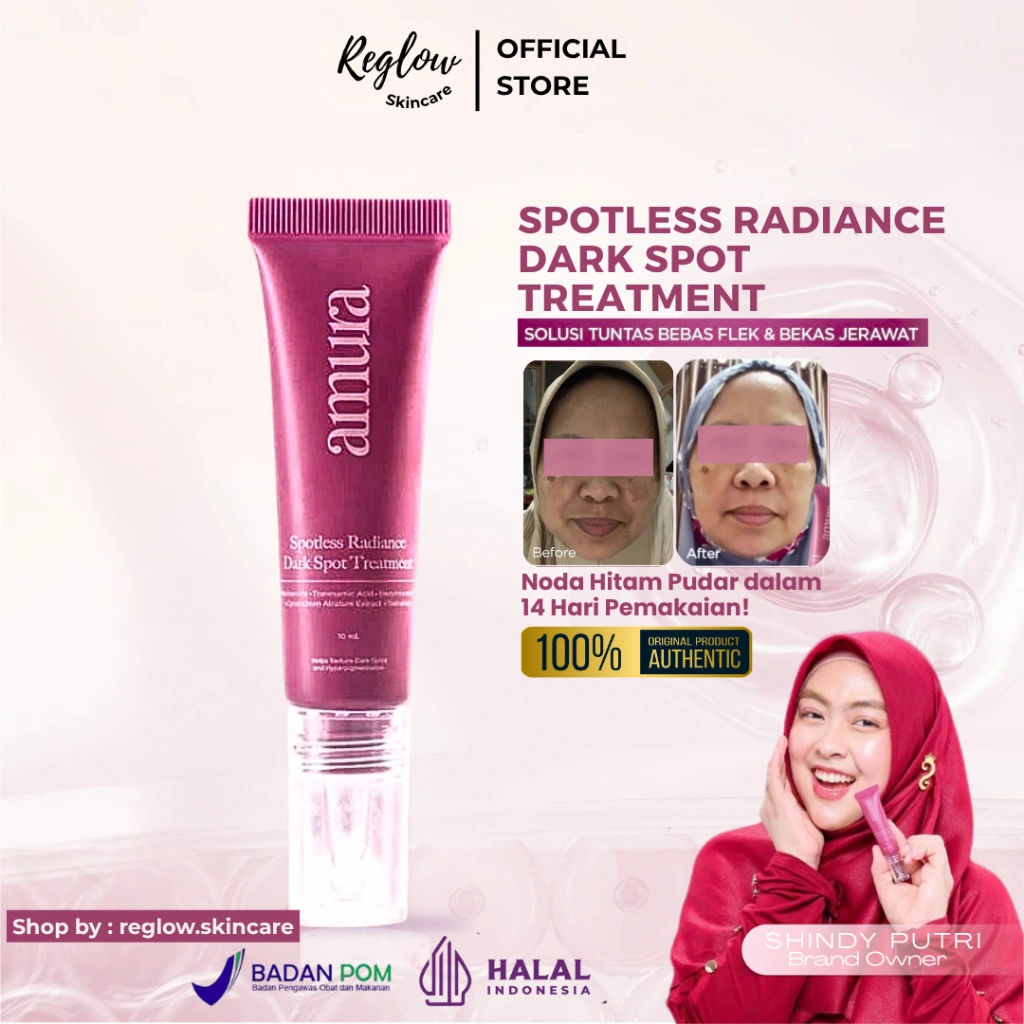 AMURA by Shindy Spotless Radiance Dark Spot Treatment-10ml | Perawatan Flek Hitam Mencerahkan Maksimal