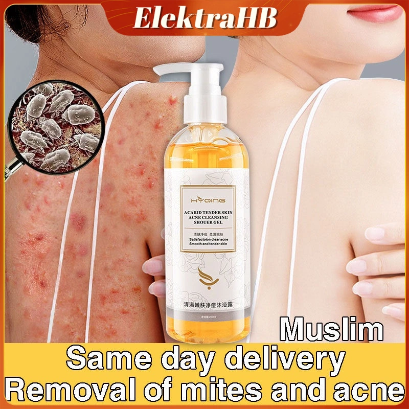 【100% ORI】Acne Body Wash 260ml Kurap gatal kulit jamur kulit eksim lotion eksim bayi Gel mandi Sabun Parfum Alami Shower Gel Jerawat Kulit, Gatal Antibakteri, repair jerawat punggung dan dada, menghilangkan tungau dan jerawat