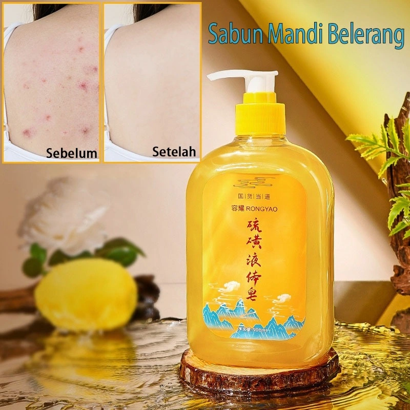 Penghilang tungau Sabun Cair Belerang 500ML Menghilangkan jerawat Menghentikan gatal Sabun Mandi