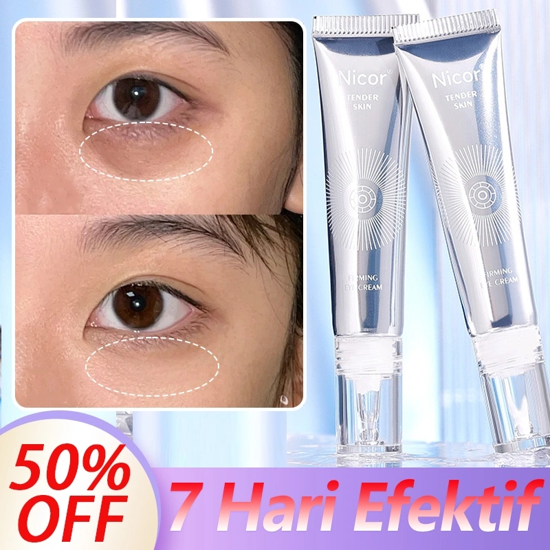Eye Cream Mata Panda Krim Penghilang Mata Panda Memudarkan Kantong Mata