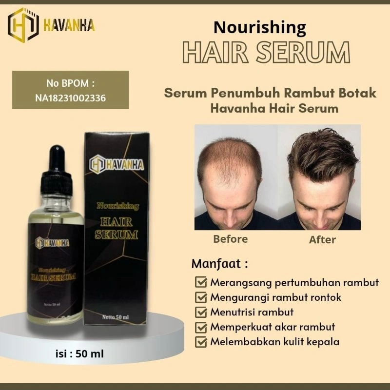 HAVANHA PENUMBUH RAMBUT BOTAK Pria Cepat Hair Growth Serum Rambut Rontok Wanita BPOM Penebal Pelebat Penyubur Minyak Kemiri Oil dewasa Alami Aman Ampuh