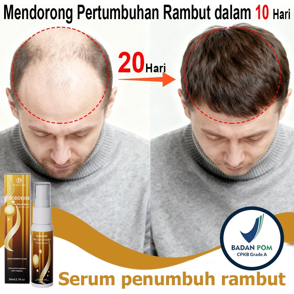 Serum rambut rontok hair tonic rambut rontok serum penumbuh rambut 30ml hair obat penumbuh rambut penumbuh rambut cepat dan tebal penumbuh rambut botak serum rambut rontok hair tonic penumbuh rambut Penumbuh Rambut Cepat Anti Rontok minyak