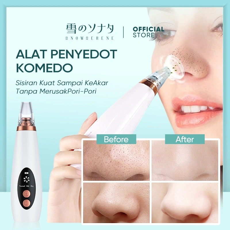 Penghilang komedo penyedot debu pembersih komedo penghilang komedo hidung dan pembersih zona T.