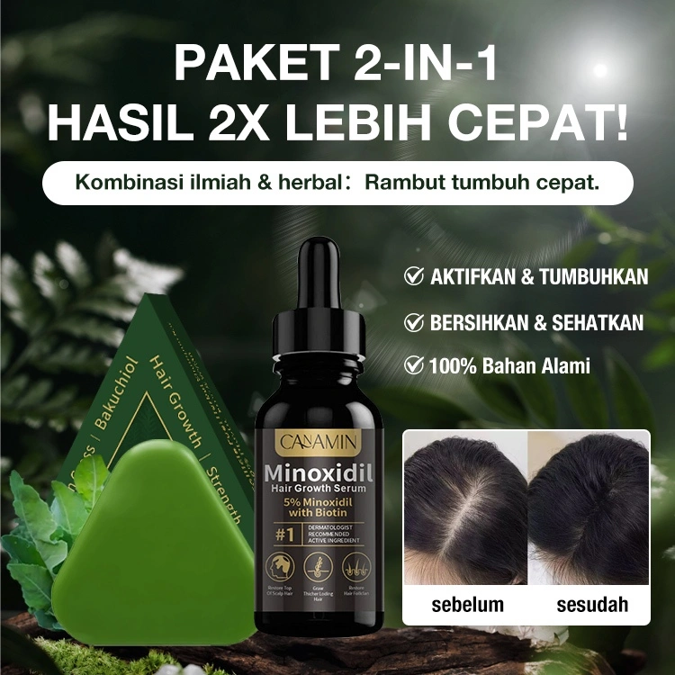 [Free Net] Biotin Minoxidil 5% Hair Growth Serum 30ml + Usman Grass Shampoo Bar 100g Anti Hair Fall Serum Rambut Rontok Minoxidil Penumbuh Rambut Original 100% Penumbuh Rambut Botak dan Cegah Rontok Hair Oil Serum Minoxidil Original 100%