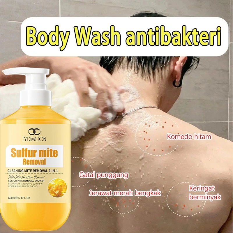 Eczema Body Wash Sabun Jerawat Punggung Sabun Cair Belerang 500ML Acne Shower Gel Mengatasi Kulit Jerawat Kering Gatal Anti Jamur Menghilangkan jerawat Menghilangkan gatal