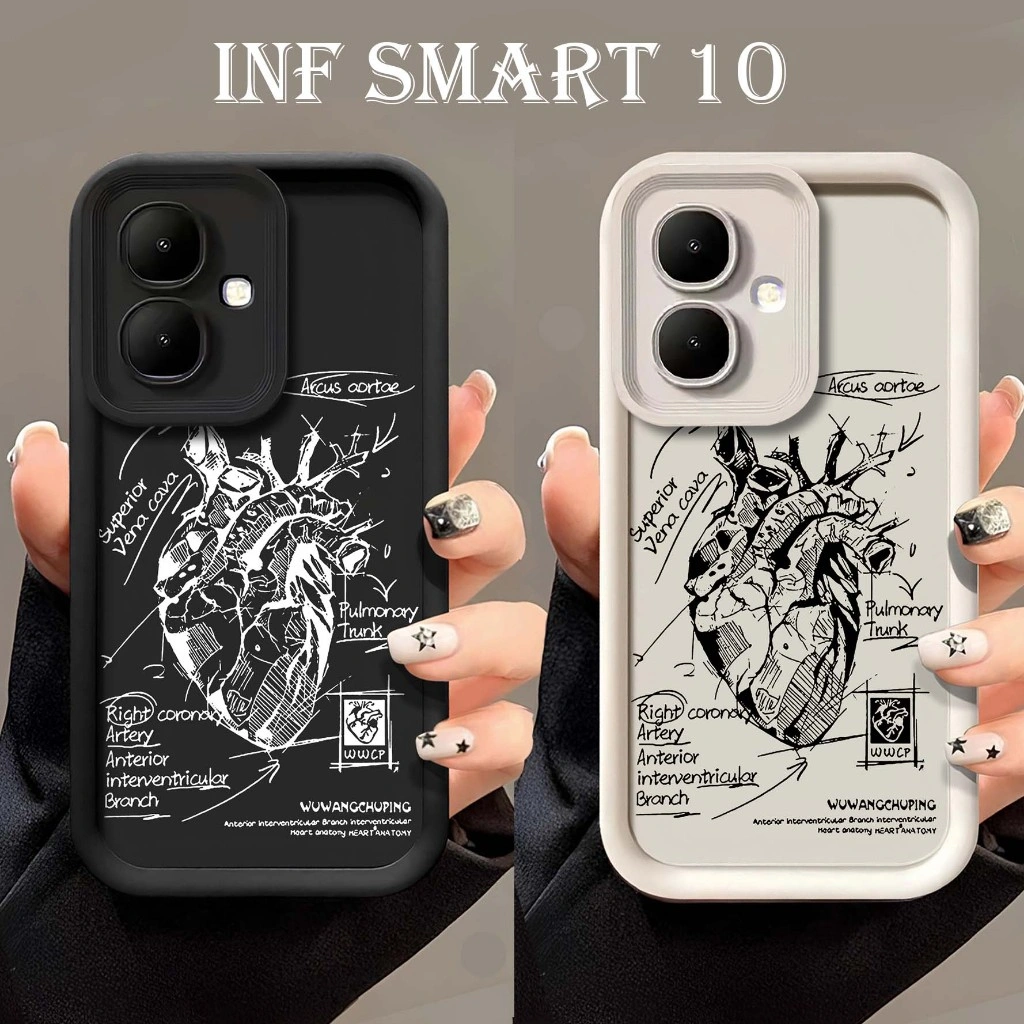 SoftCase Rubber Motif Logo For INFINIX Smart 10 Tecno Spark Go 2 SMART 9 Hot 50i Smart 10plus Hot 60i Hot 60 Pro Hot 60 Pro Plus Note 50S 5G Note 50X 5G Gt 30 Pro 5G c53 c63 realme note50  hot 50 4g hot 50 pro 4g hot 50 pro plus - Softcase terlaris new