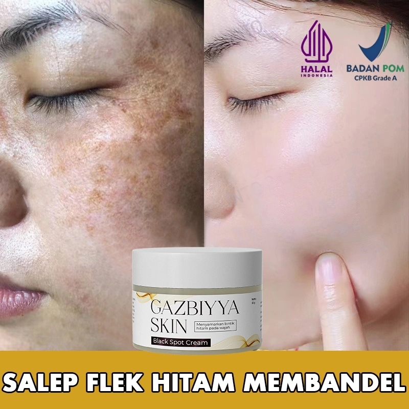 Krim penghilang flek hitam cream flek hitam membandel salep flek hitam membandel 30g menghilangkan flek hitam di wajah serum flek hitam Perawatan wajah Krim bintik Perbaikan bekas luka dan bintik bintik secara permanen dan efektif