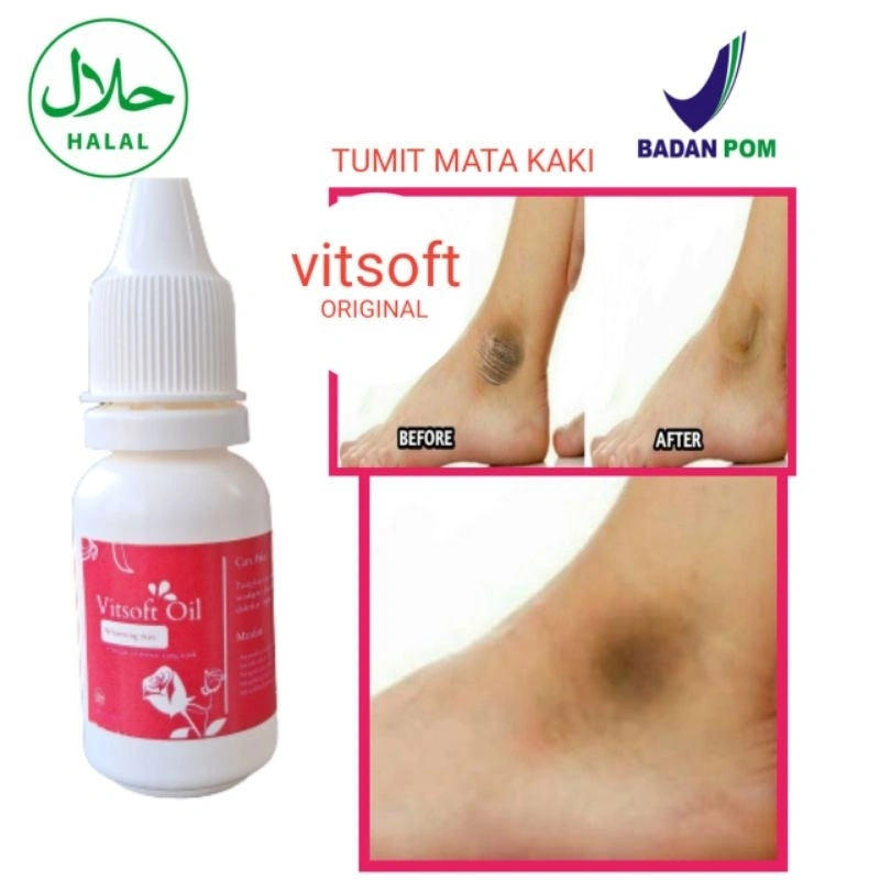 VITSOFT PEMUTIH TUMIT MATA KAKI DENGKUL DAN SIKUT PERAWATAN KULIT