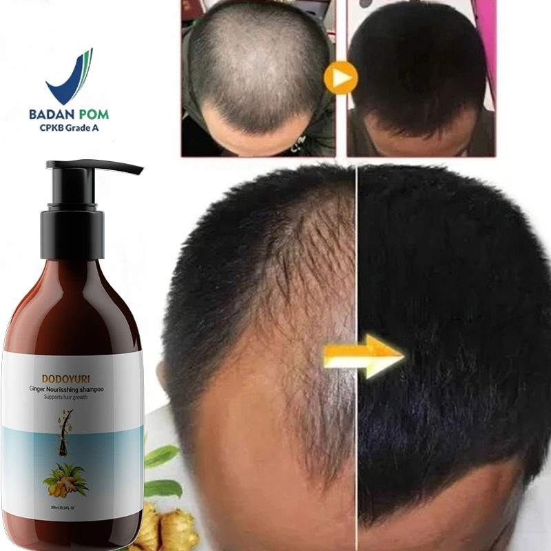 Shampoo rambut rontok sampo penumbuh rambut cepat sampo anti ketombe dan rontok penumbuh rambut cepat 300ml shampo anti ketombe dan rontok rontok penumbuh rambut perawatan hair care treatment anti rambut rontok meningkatkan pertumbuhan rambut