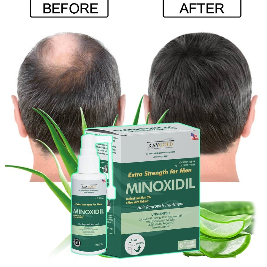 MINOXIDIL 5% penumbuh rambut & brewok with Aloe Vera for MEN made in USA - RAYGOLD - MINOX MINOKSIDIL anti rontok & kebotakan SERUM RAMBUT HAIR TONIC HAIRTONIK KIRKLAND BOURN HIMS ROEGAN ROGAINE