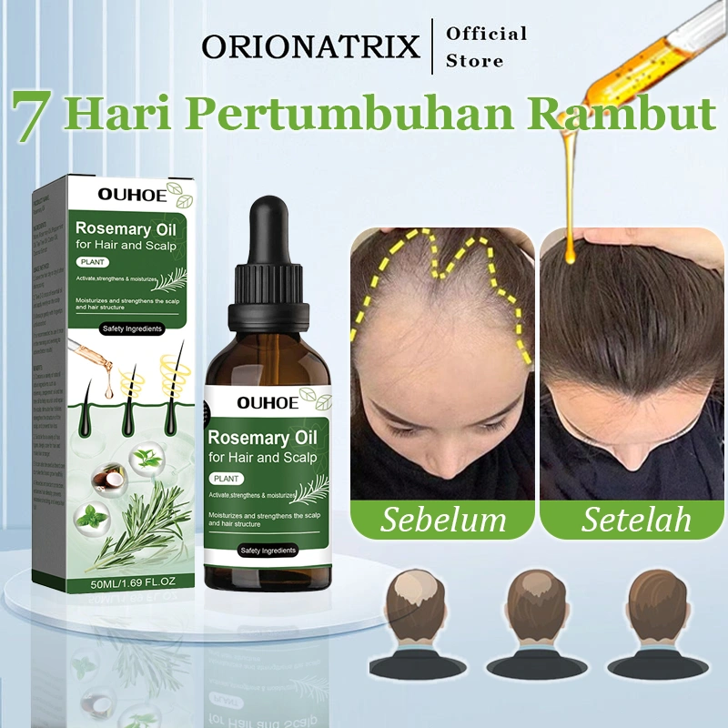 Orionatrix Hair Serum Penumbuh Rambut Botak Minyak Rosemary Oil Rambut Obat Penumbuh Rambut Cepat Dan Tebal Rosemary Hair Growth Oil Melebatkan Rambut Rontok Pelebat Rambut Pria
