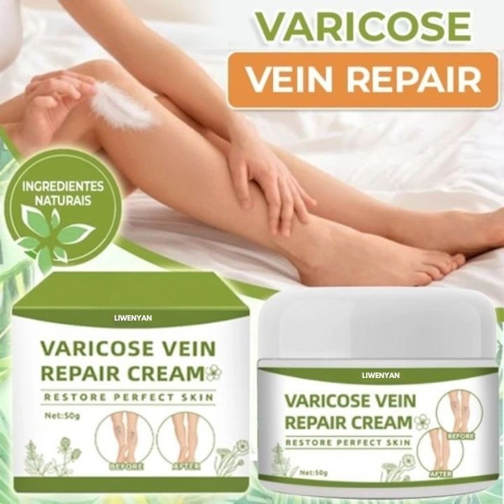 Liwenyan Varicose Veins Cream | Krim Efektif Penghilang Varises Di Kaki