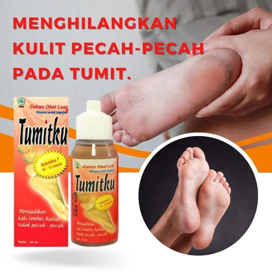 Tumitku Original Bpom Penghalus Tumit Kaki Penghilang Kaki Pecah Dan Kering