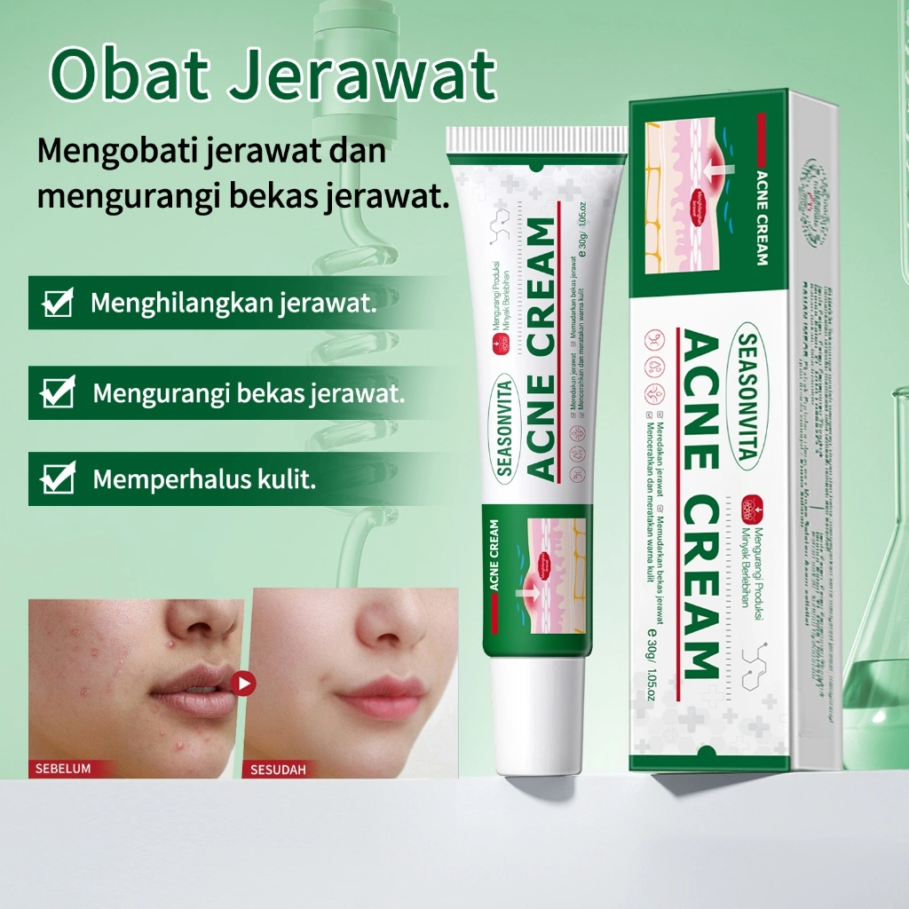 HERBAL ACNE CREAM cinsulin krim Penghapusan jerawat dan bintik Krim jerawat efektif jerawat spot gel perawatan jerawat dan penghapusan bekas luka jerawat efek cepat perawatan perbaikan wajah penghapusan jerawat