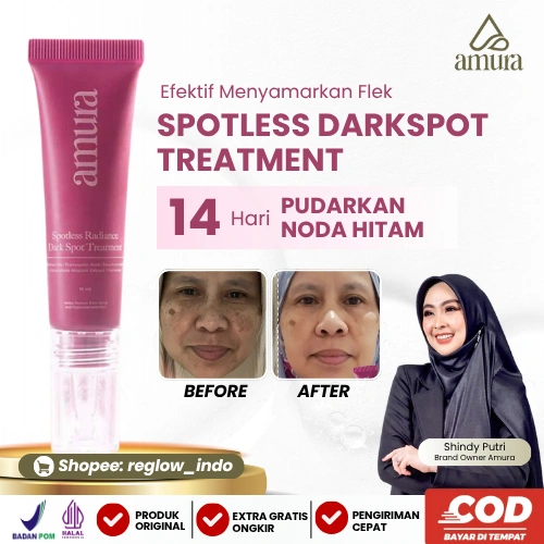 Amura Spotless Radiance Dark Spot Treatment Untuk Memudarkan Noda Flek Hitam di Wajah