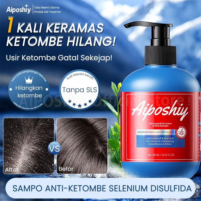 Aiposhiy Anti Dandruff Shampoo Ketombe Ampuh Selenium Disulfide Sampo Anti Ketombe Dan Gatal Oil Control Memperbaiki Rambut Bercabang Dan Rusak 300ml