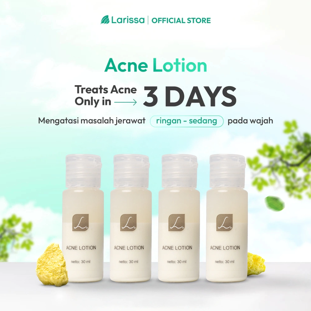 Acne Lotion Larissa  / totol Jerawat Larissa (Obat Jerawat Larissa)