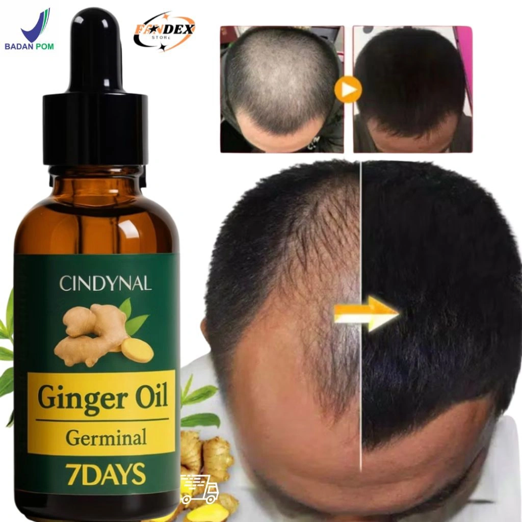 [ BPOM ] SERUM PENUMBUH RAMBUT BOTAK Anti Rontok / Botak Asli Obat Uban Penghitam Penyubur Original 7 Days Cindynal