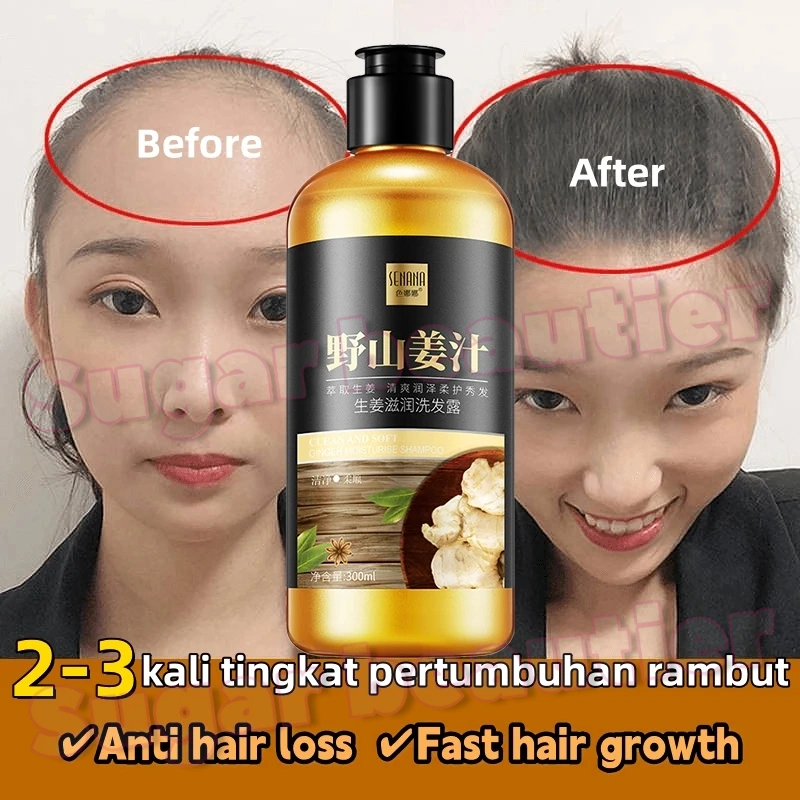 Shampo Penumbuh Rambut Cepat Ginger Shampoo 300ml pertumbuhan rambut Pengendalian Minyak Anti rambut rontok Botak shampo penumbuh rambut sampo anti ketombe dan rontok Anti Hair Fall Hair Treatment Shampoo Mengurangi Rambut Rontok