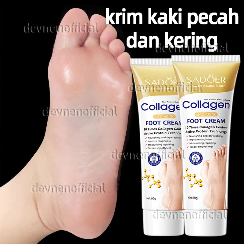 krim kaki pecah dan kering collagen Foot cream Obat kaki pecah Pelembab kaki kering dan pecah Penghalus kaki kasar dan pecah Ultra Pelembab Obat Tumit Kaki Dan Tangan Kering Cream Tumit Kaki Pecah Dan Kering Salep Penghilang Pecah Pecah Di Kaki