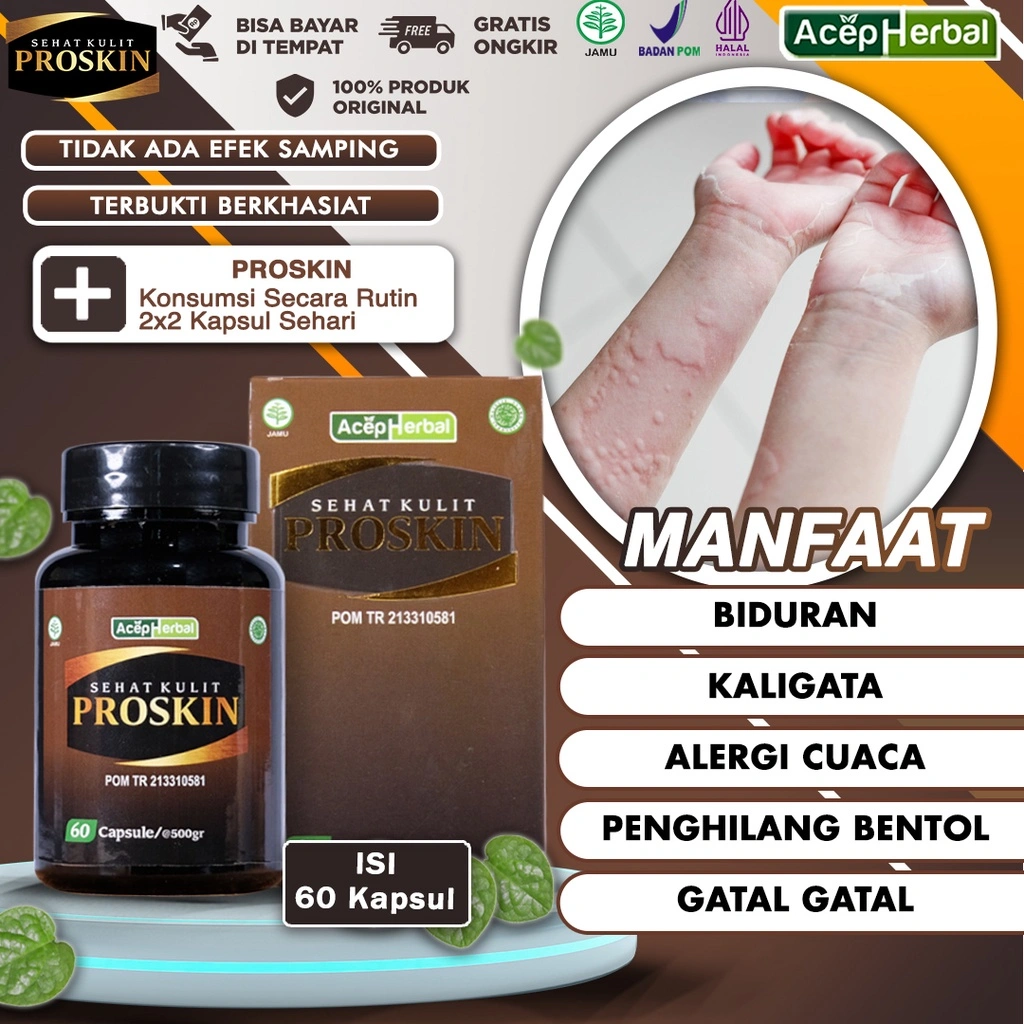 Obat Biduran Gatal Kulit Alergi Dingin Paling Alami untuk Penghilang Bentol Gatel Alergi Makanan Kaligata di Tangan Badan Wajah pada Anak dan Dewasa Suplemen Herbal Ekstrak Daun Binahong PROSKIN BPOM Non Caladine Tanpa Efek Samping Bedak Salep