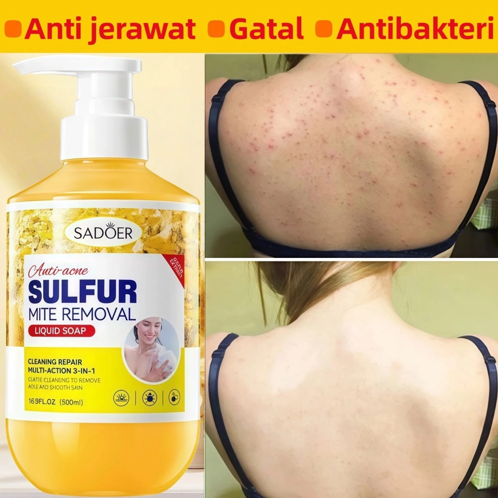 SADOER Sulfur Shower Gel 500ml menghilangkan tungau, membunuh bakteri, menghilangkan jerawat, mengatasi jerawat, dan memberikan kelembaban yang tahan lama